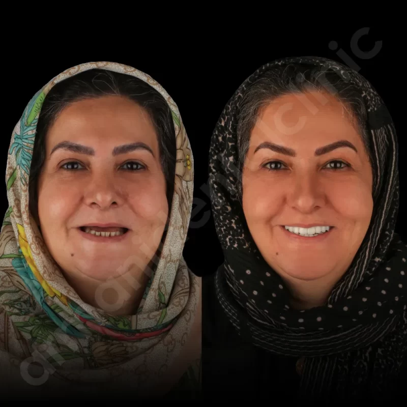 آرمانی 37