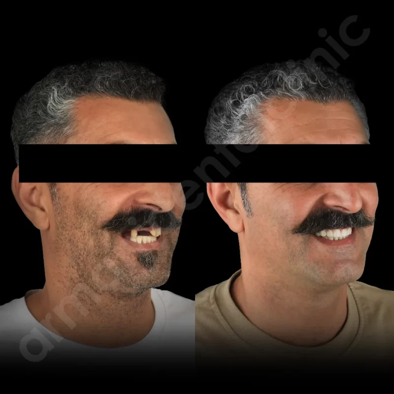 آرمانی 42