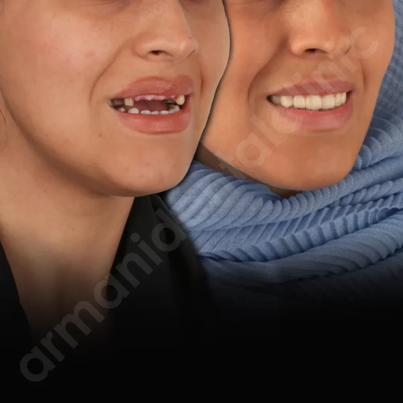 آرمانی 48