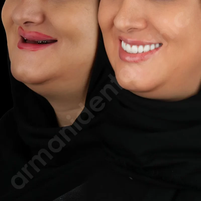 آرمانی 5
