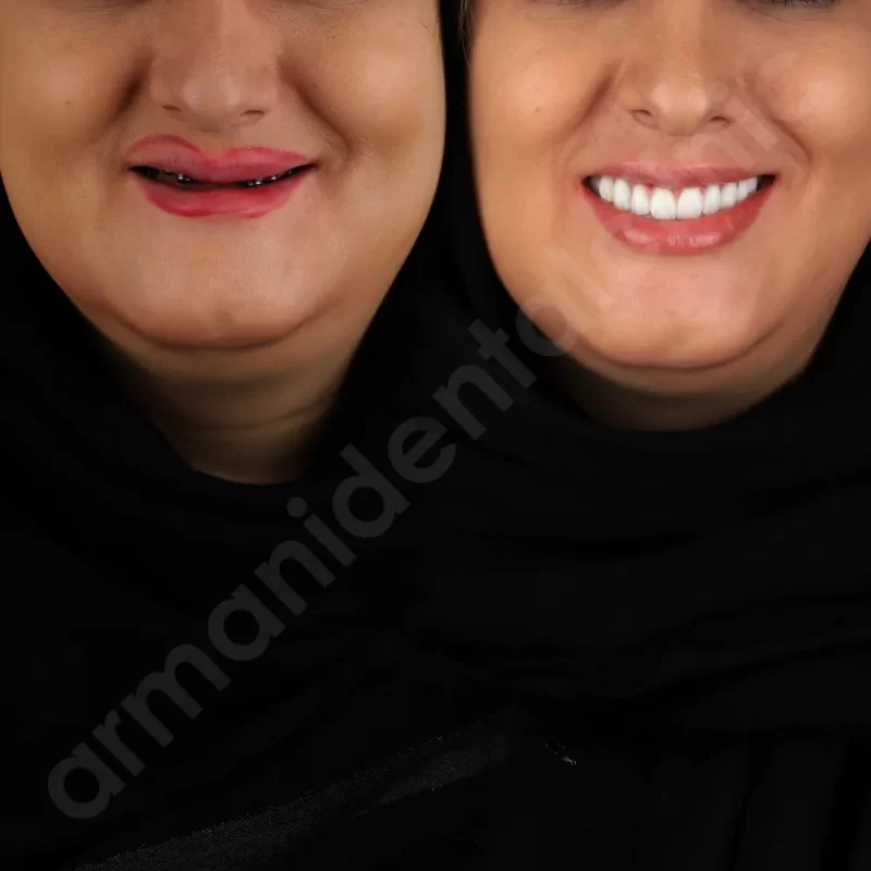 آرمانی 6