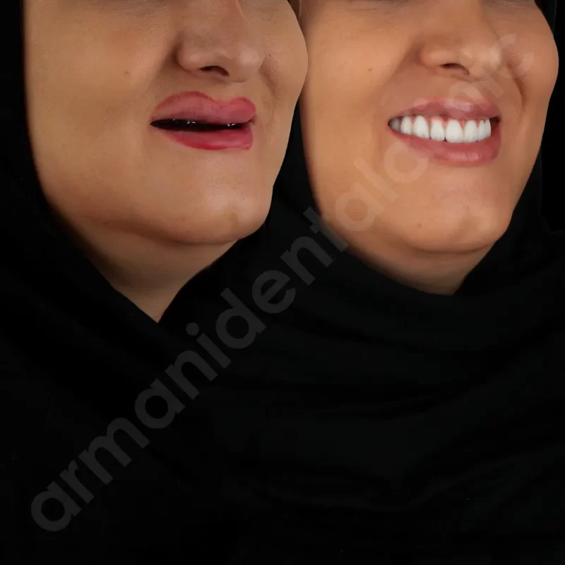آرمانی 7