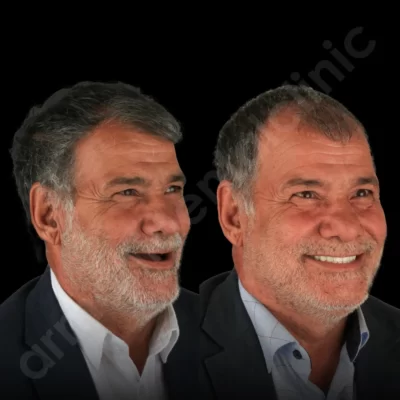 آرمانی 71