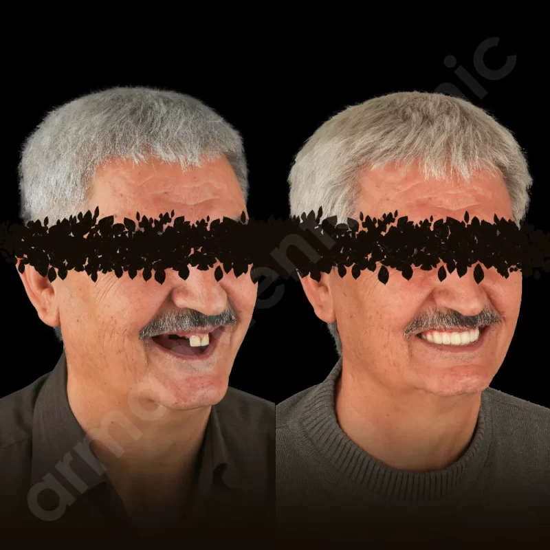آرمانی 72