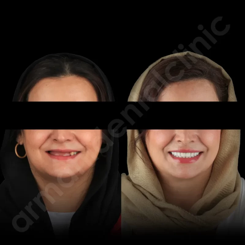 آرمانی 76