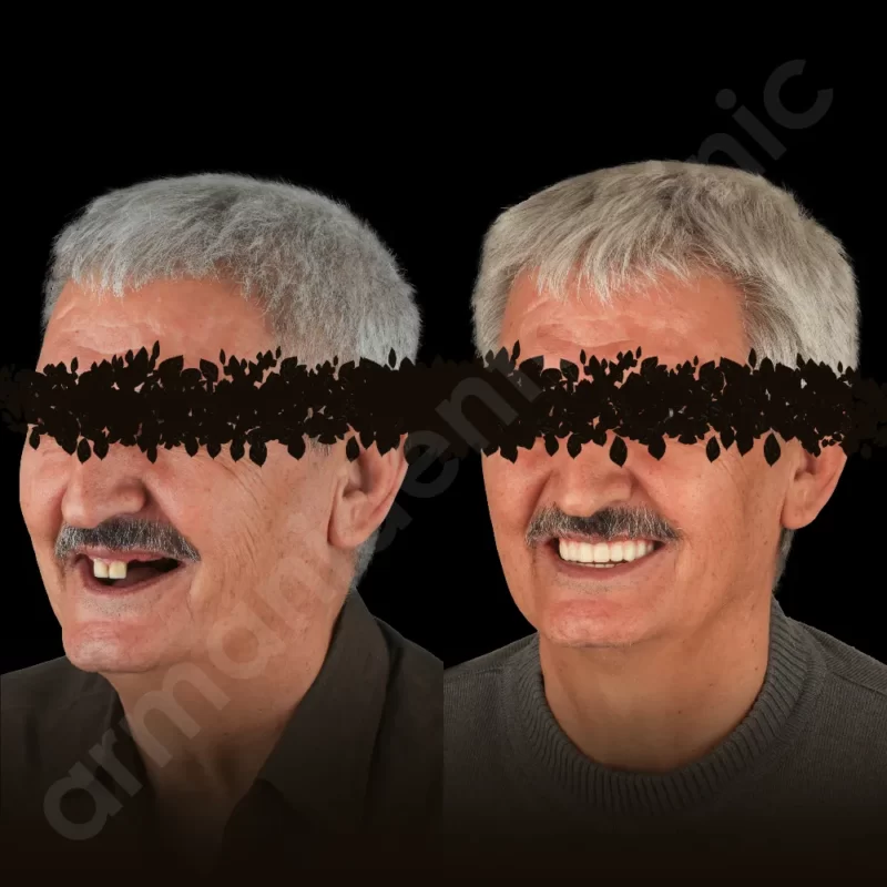 آرمانی 86