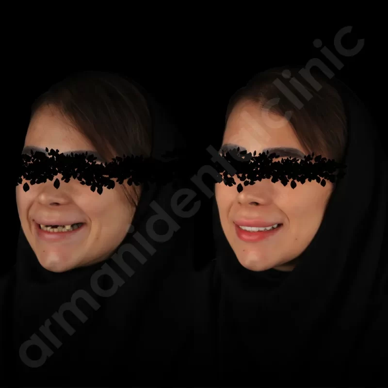 کلینیک آرمانی 30