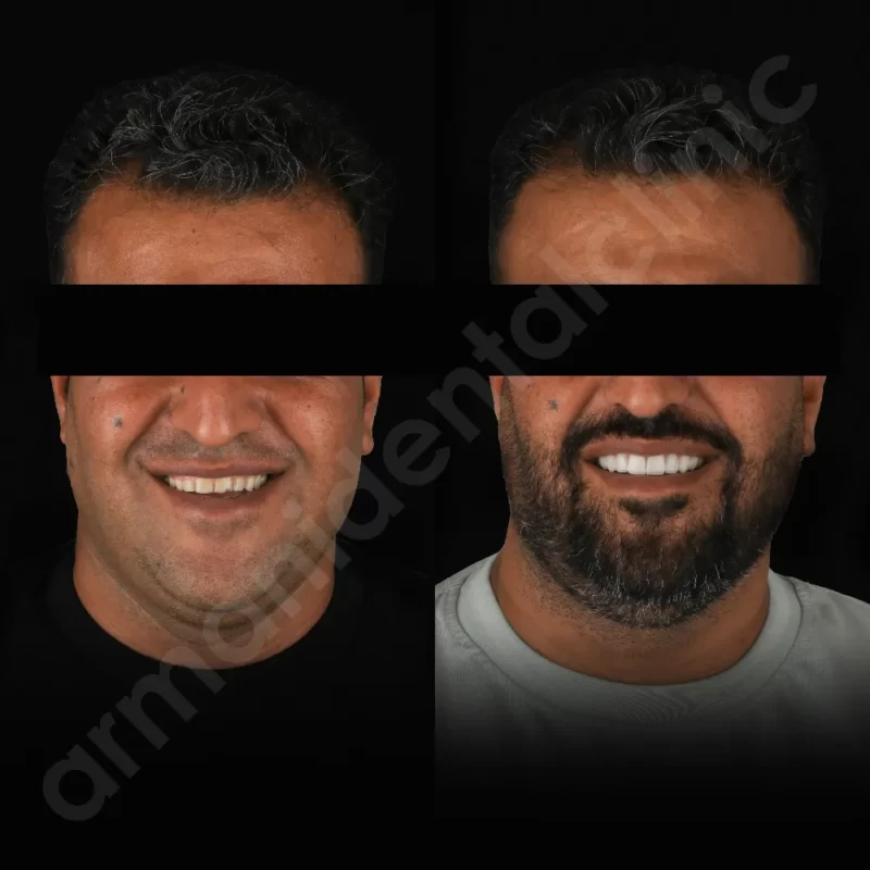کلینیک آرمانی 35