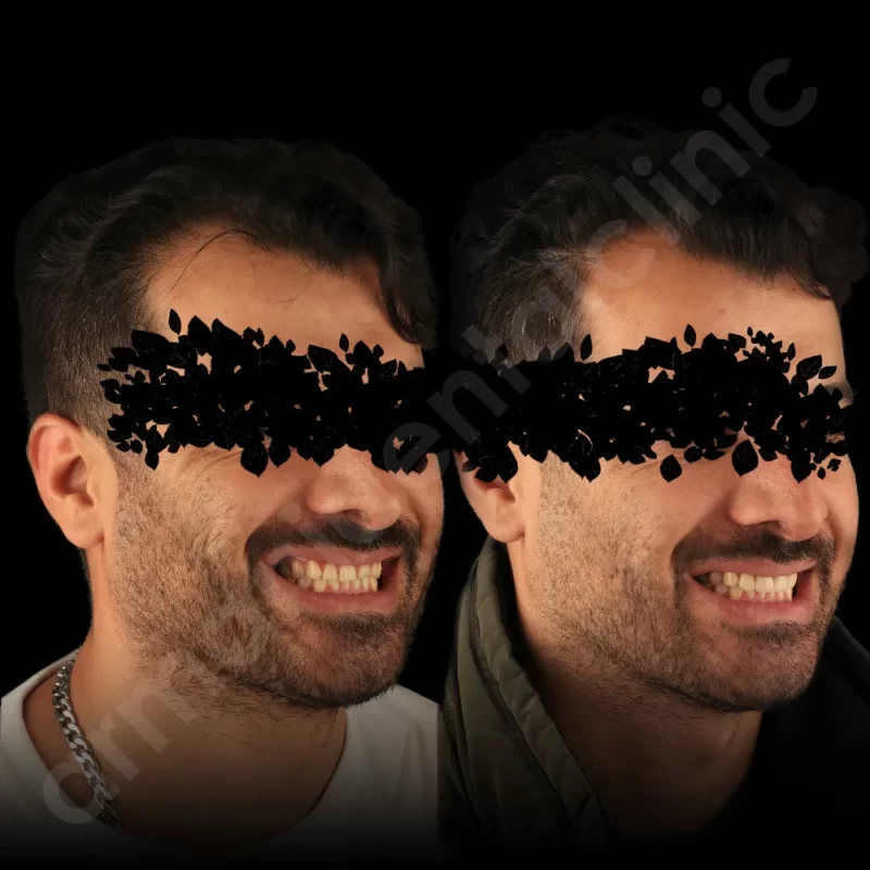 کلینیک آرمانی 44