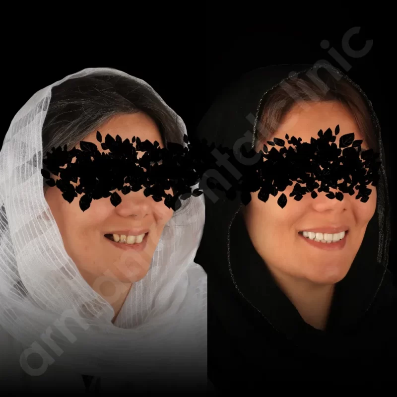 کلینیک آرمانی 55